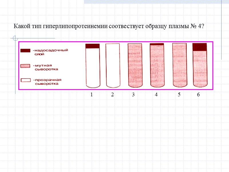 Какой тип гиперлипопротеинемии соотвествует образцу плазмы № 4?  1 3 5 4 6